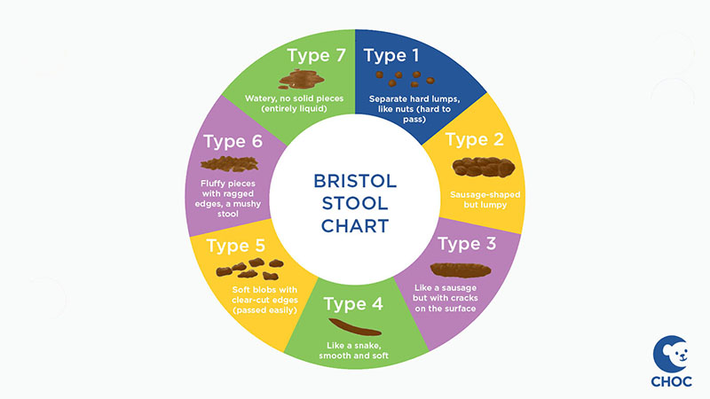 Bristol Stool Chart showing range of stool textures and shapes, from hard and lumpy to watery
