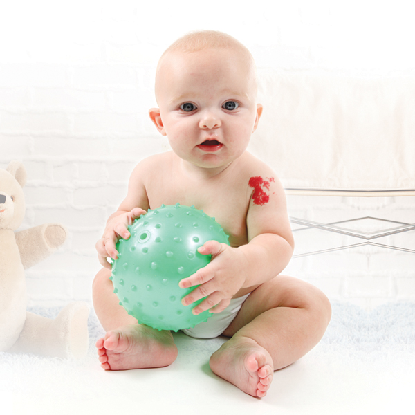 Baby with birth mark holding ball