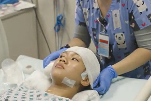 Realización de un monitoreo con videoencefalografía (EEG) continua