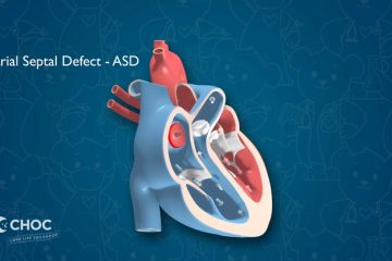Heart – Atrial Septal Defect