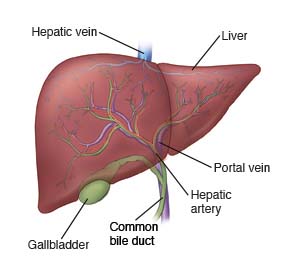 Liver disease graphic