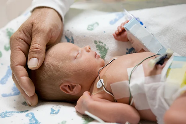 baby in NICU