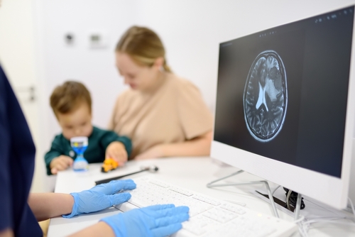 Movement Disorders Program