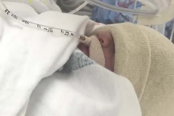 Nathan's NICU Journey - CHOC Children's